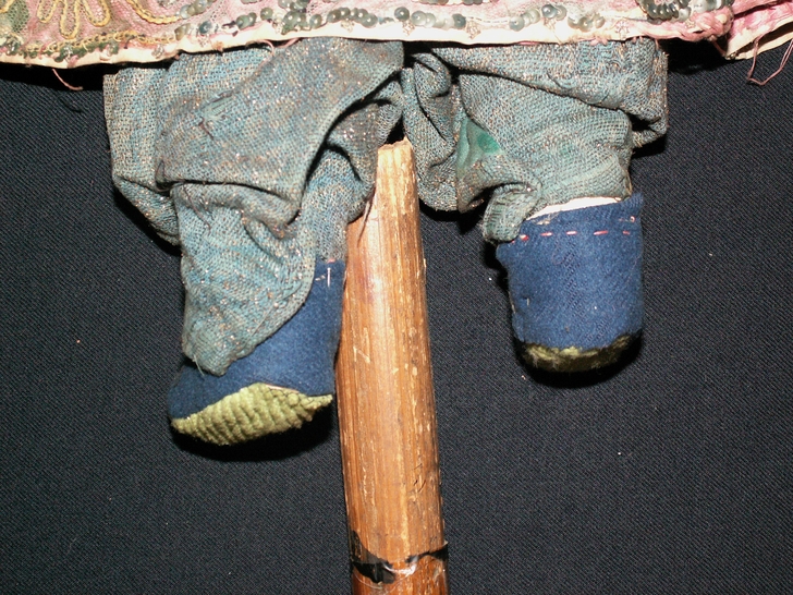 Piedi prima del restauro